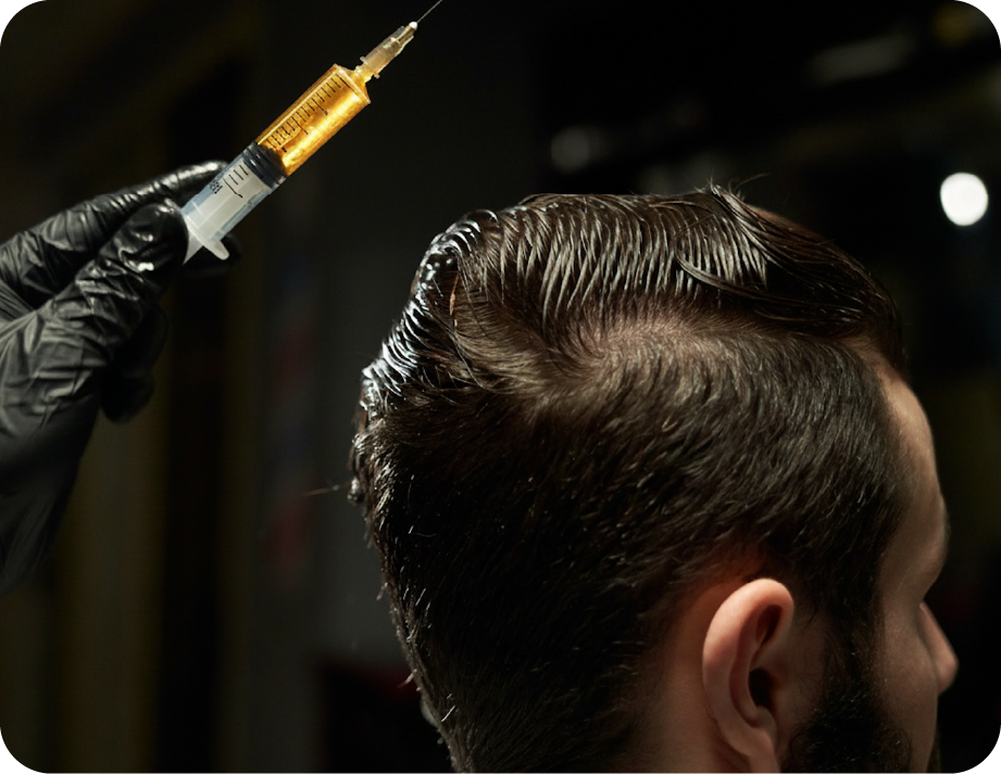 [Imagen de injerto de cabello]